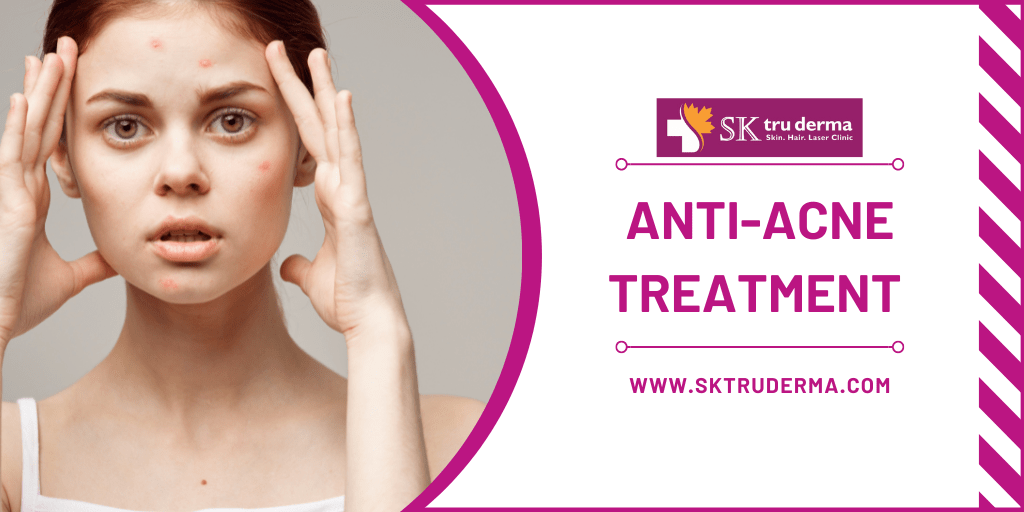 Anti-Acne Treatment | Best Skin Clinic in Bangalore | sktruderma