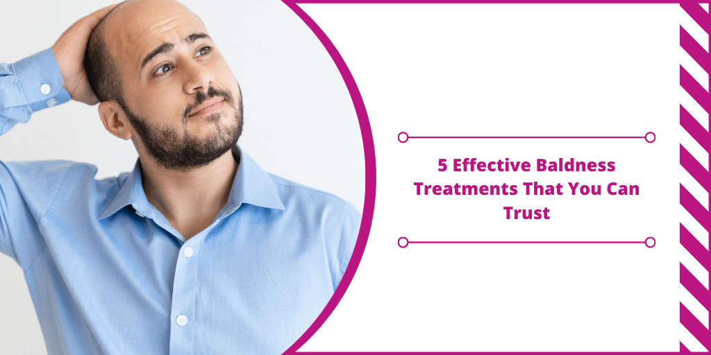 5 Effective Baldness Treatments That You Can Trust | Dermatologist in Sarjapur Road