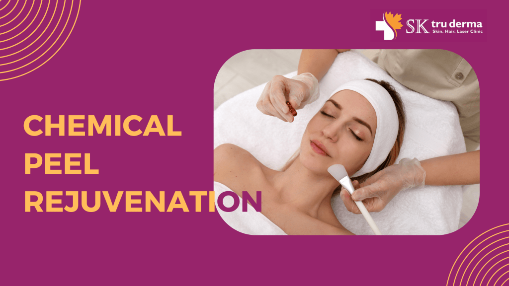 Chemical Peel Treatment in Sarjapur Road, Bangalore | SkTruderma